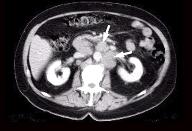 Imaging Prostate Cancer - myCME